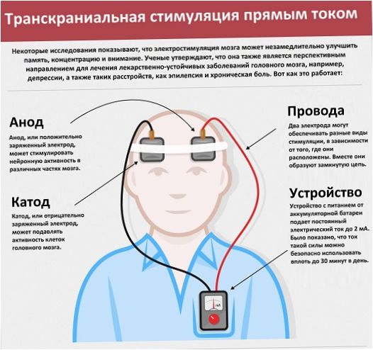 TDCS metodikos esmė